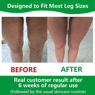 Sakerplus Cellulite Massage Roller